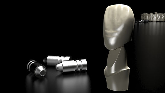 abutments2 copy.jpg