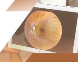 Retinografia-OPC-Oftalmologia-Clinica-e-Cirurgica.webp