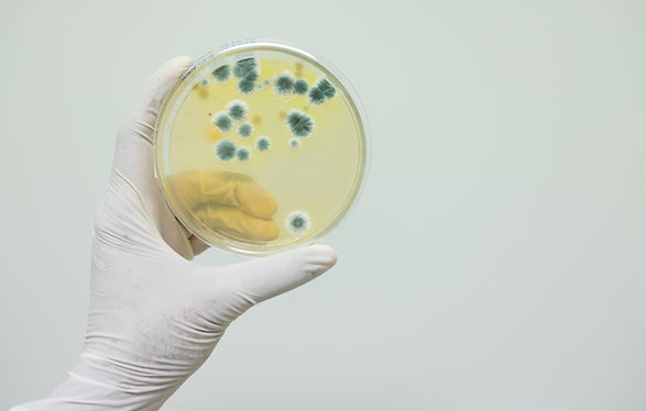 Certified mold testing sample in Port St. Lucie, Florida by Home & Beyond Services