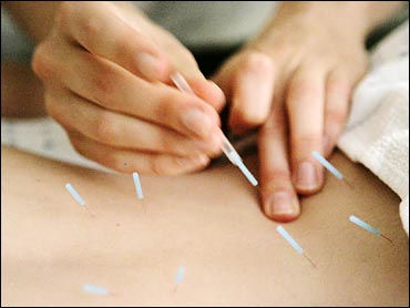 Study: Acupuncture Good For Aching Backs