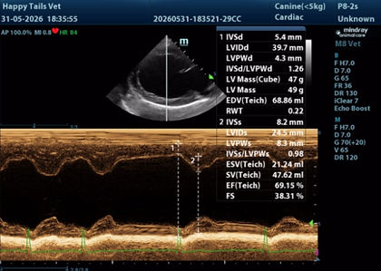 Ultrasound heart contractility