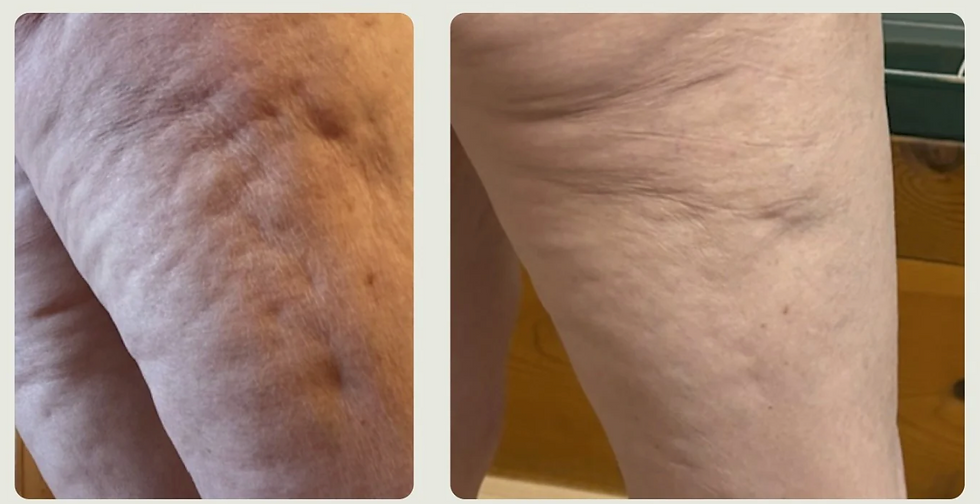 Thumbnail: ADIPEAU STRENGHT BODY GEL