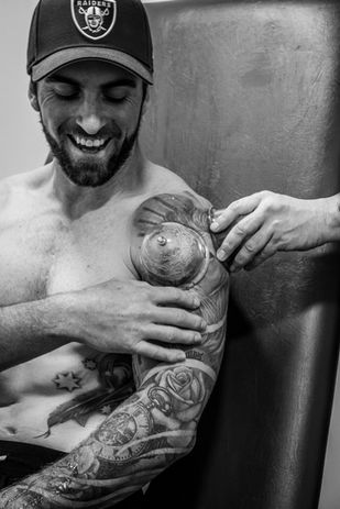 Cupping Treatment being done on a client. Image credit Danielle Oldbury.