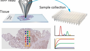 Master Thesis project in Tissue screening