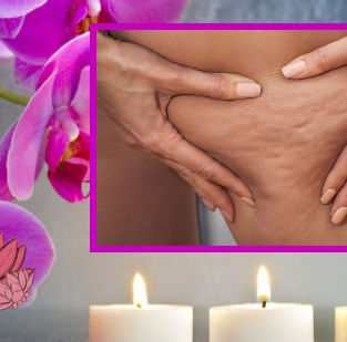  Qu'est-ce que la cellulite et pourquoi en ai-je ?