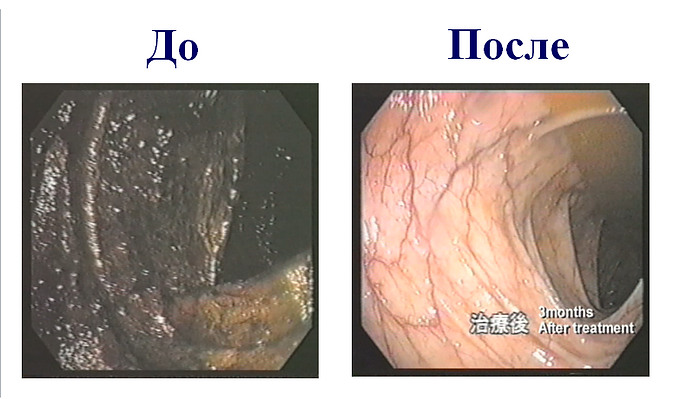 КАНГЕН ВОДА_+7(926) 954-41-00_канген аппарат купить в Москве_www.super-voda.com