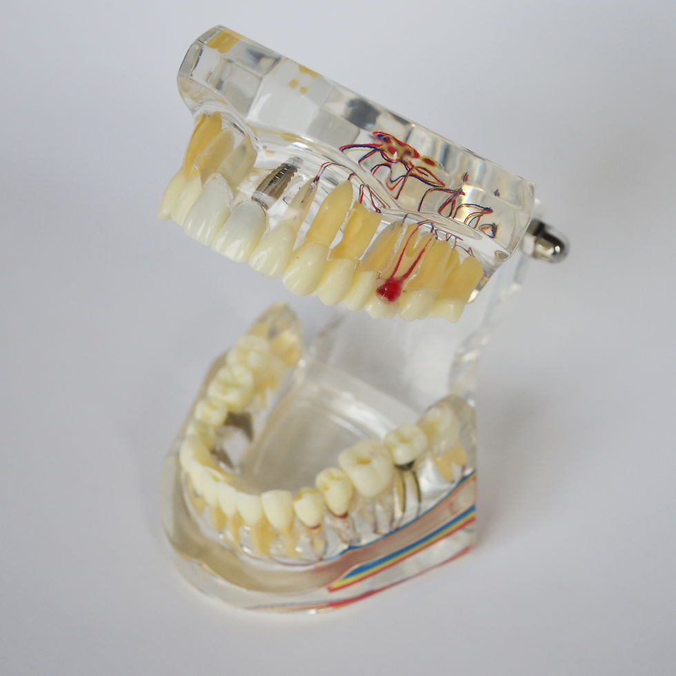 Thumbnail: General Dental Model with Implant Restoration Pathology