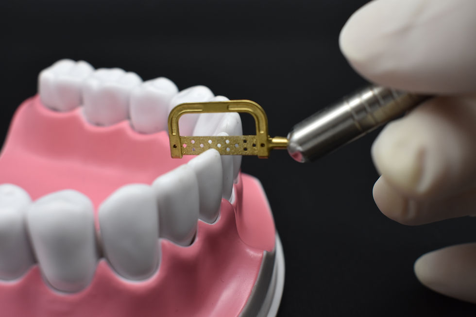 Thumbnail: Interproximal Reduction(IPR)