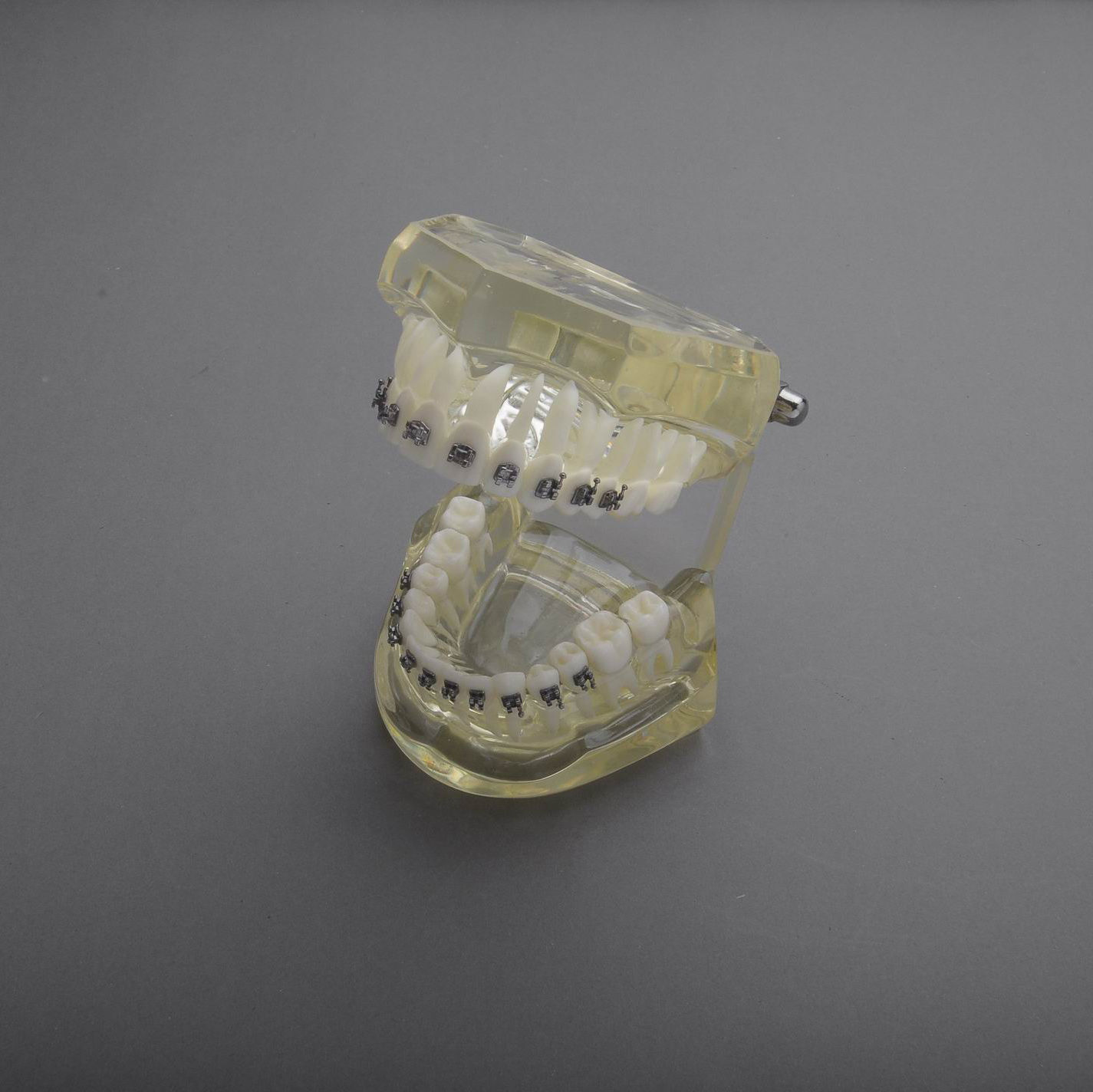 Orthodontic Model with Metal Brackets