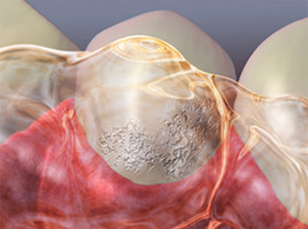 Soda Or Pop? It's Teeth Trouble By Any Name