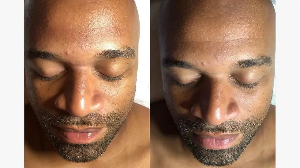 crystal facial