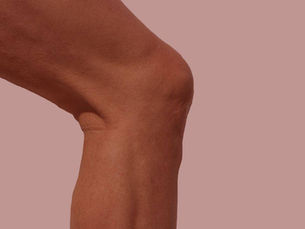 Learning to Move Again: The Challenges of Post-Surgery Rehab