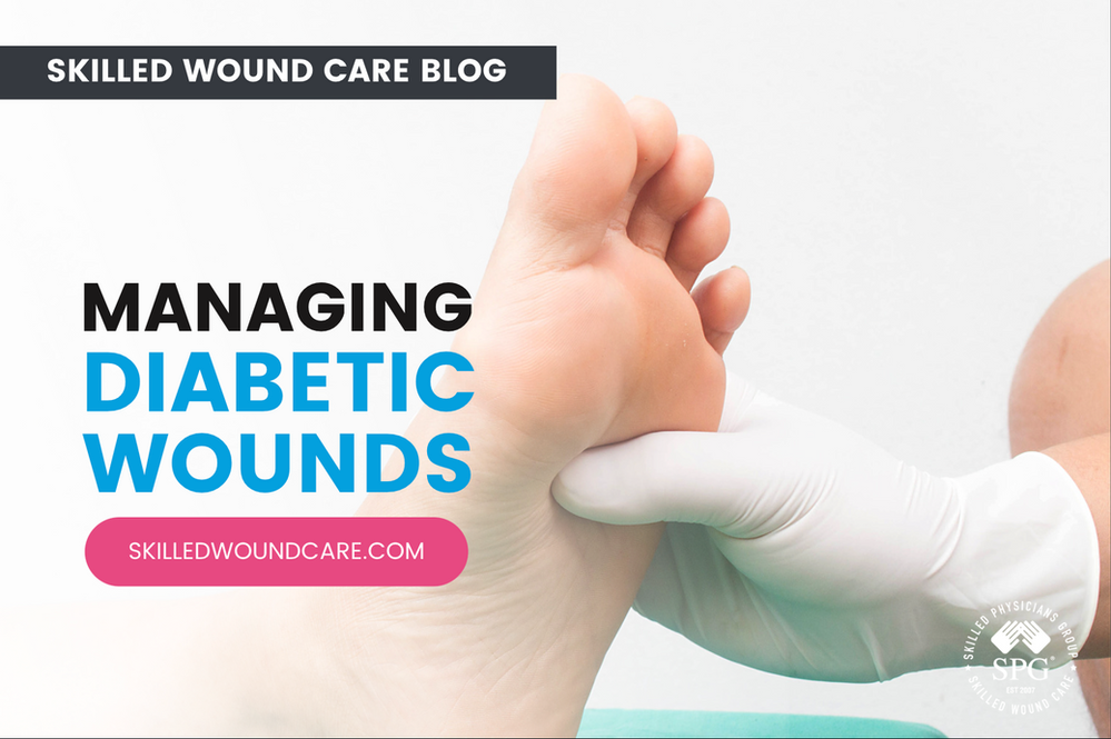 Managing Diabetic Wounds