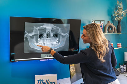 Mellion Orthodontics Medina Fairlawn orthodontic treatment plan braces Invisalign