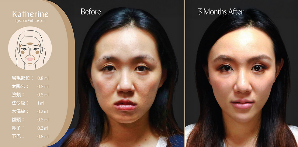 B&A-01