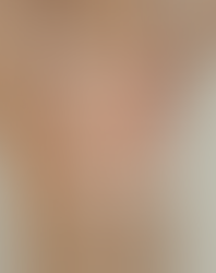 😖 Dolore localizzato, gonfiore e difficoltà nei movimenti? Potrebbe essere borsite!