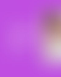 ✨ Cos’è il Lipedema? ✨