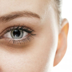 Tratamentos eficazes para suavizar olheiras