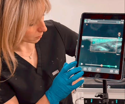 Heather Ultrasound photo.jpg