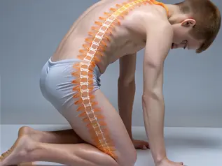 Descubra como aliviar a dor da síndrome do piriforme com essas dicas eficazes!