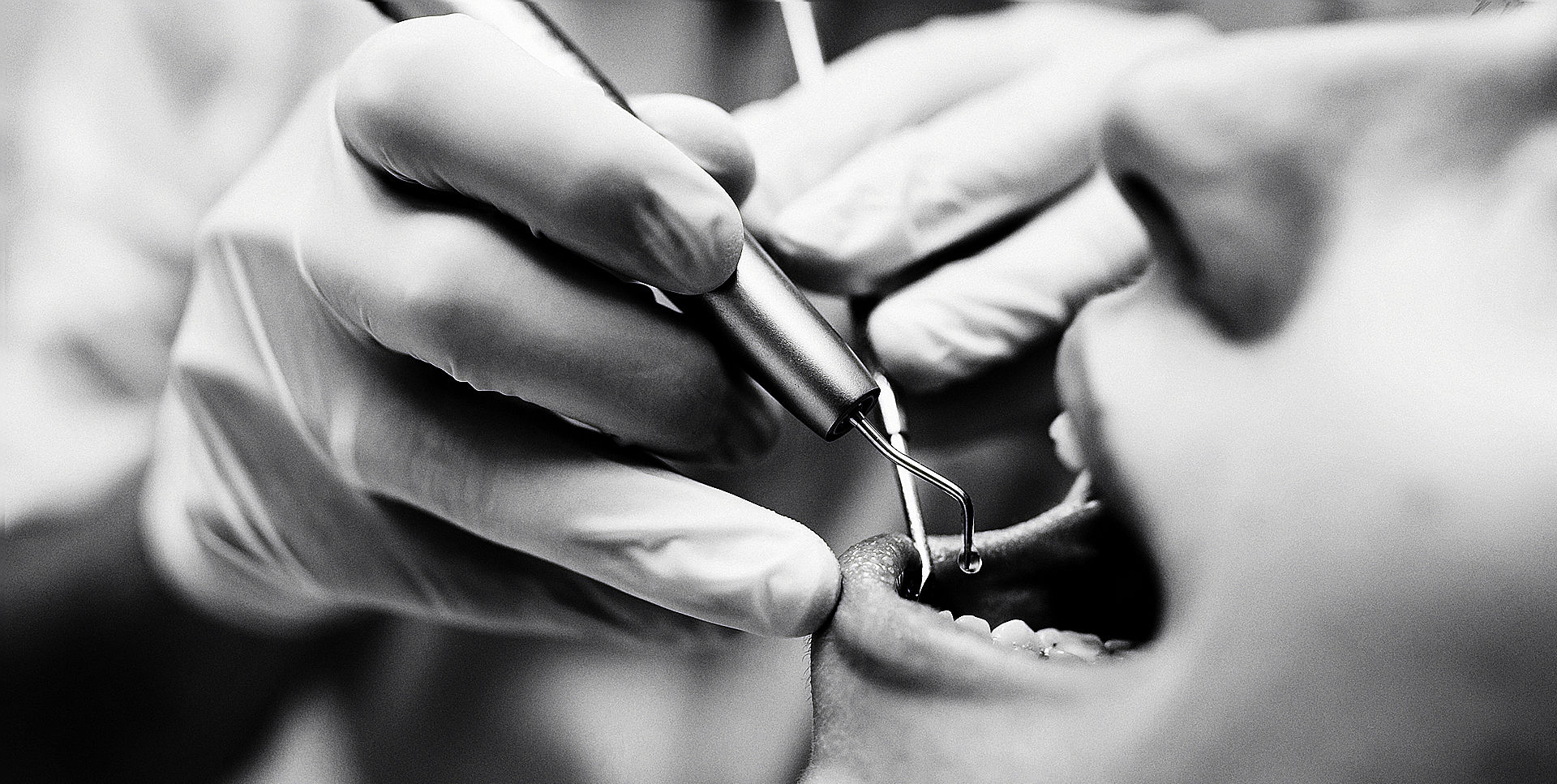 Diş hekimi diş fırçasıyla çalışıyor, diş bakımı ve tedavi Klinik Nişantaşı Yorumları Tavsiye Benden