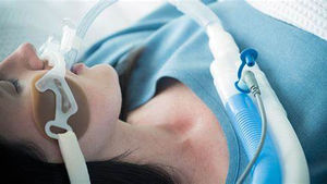 COVID-19 : VENTILATION MÉCANIQUE INVASIVE ET MORTALITÉ CHEZ LES MOINS DE 21 ANS