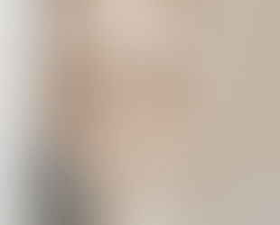 Efficacité d’un analogue du GLP1, le liraglutide, dans les troubles métaboliques chez les schizophrè