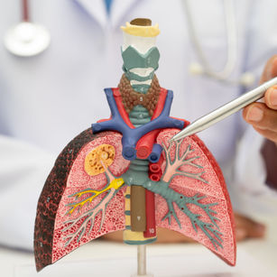 Chronic Obstructive Pulmonary Disease        