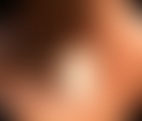 Can you explain my colonoscopy results?