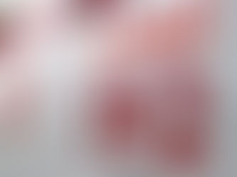 Idosa de 77 anos relata ter sido vítima de atropelamento no bairro de Nova Brasília.