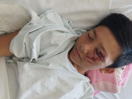 Solicitan ayuda para el pequeño Aaron, menor que le cayó barandal encima