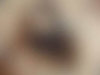 Lo pica alacran cuando trabajaba en el campo, fue trasladado al hospital