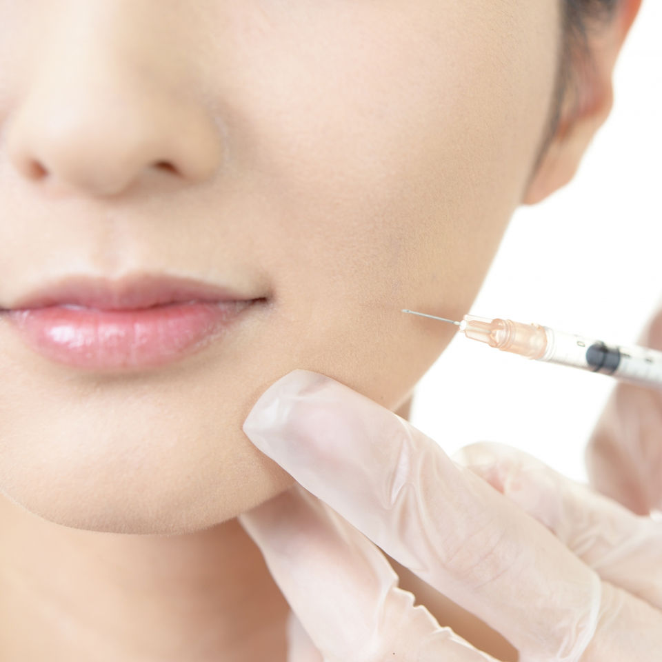 女性の顔に注射器で注入されている様子、美容整形、美容ケア、治療のイメージ。
