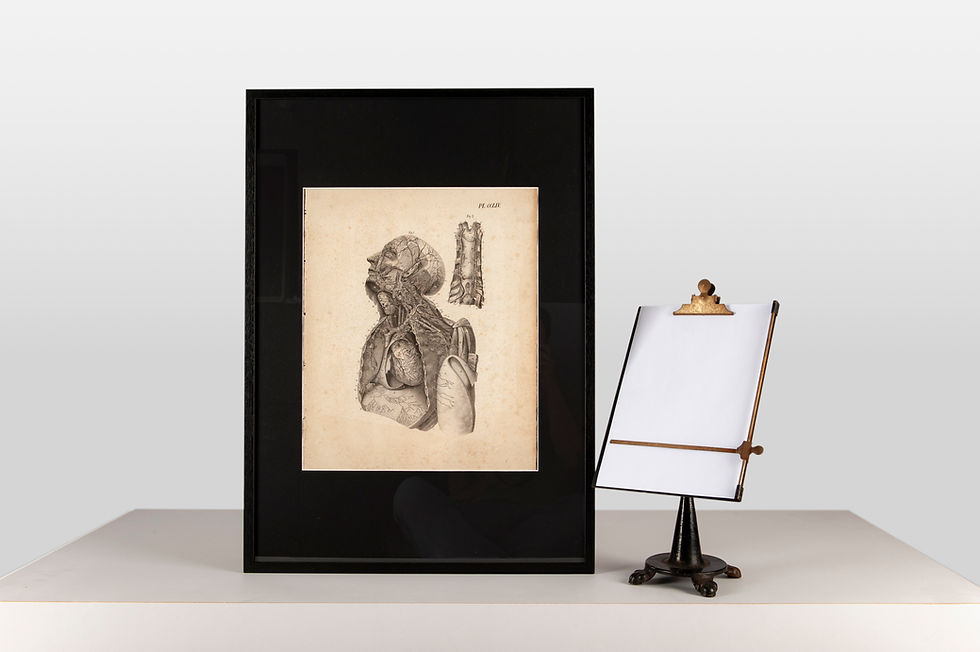 Thumbnail: Medical Lithograph 2