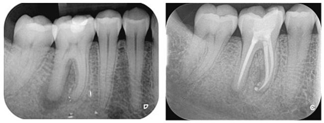 rodbehandling - hjemmeside 2.jpeg
