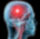 Concussion.jpg