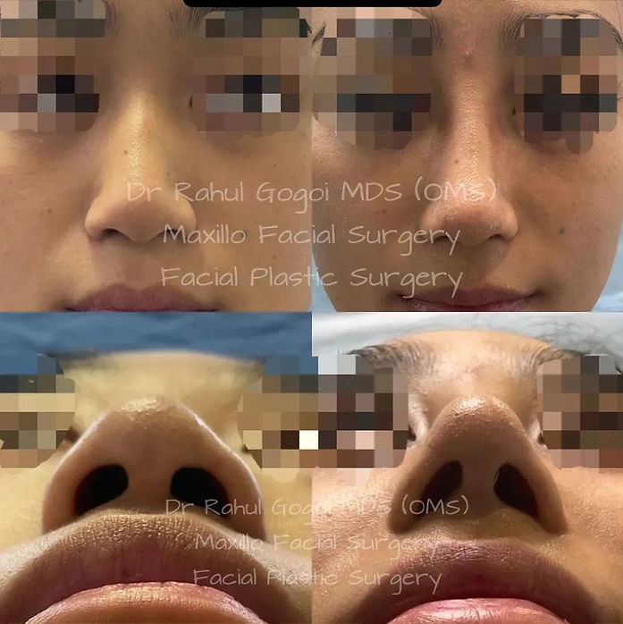 17949858889777085.webp