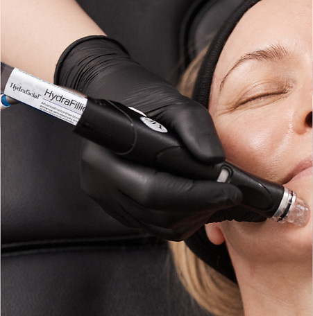 Example of Hydrafacial at Veltori Hair and Aesthetics