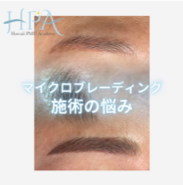 ＼解決しましょう！／マイクロブレーディング施術の悩み