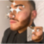 Cheek filler