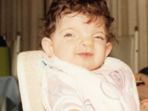 Sweet Cleft Princess Smiling