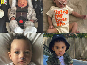 Cleft Warrior Baby Boy