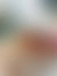 Si el intestino está sano, el alimento sí funciona