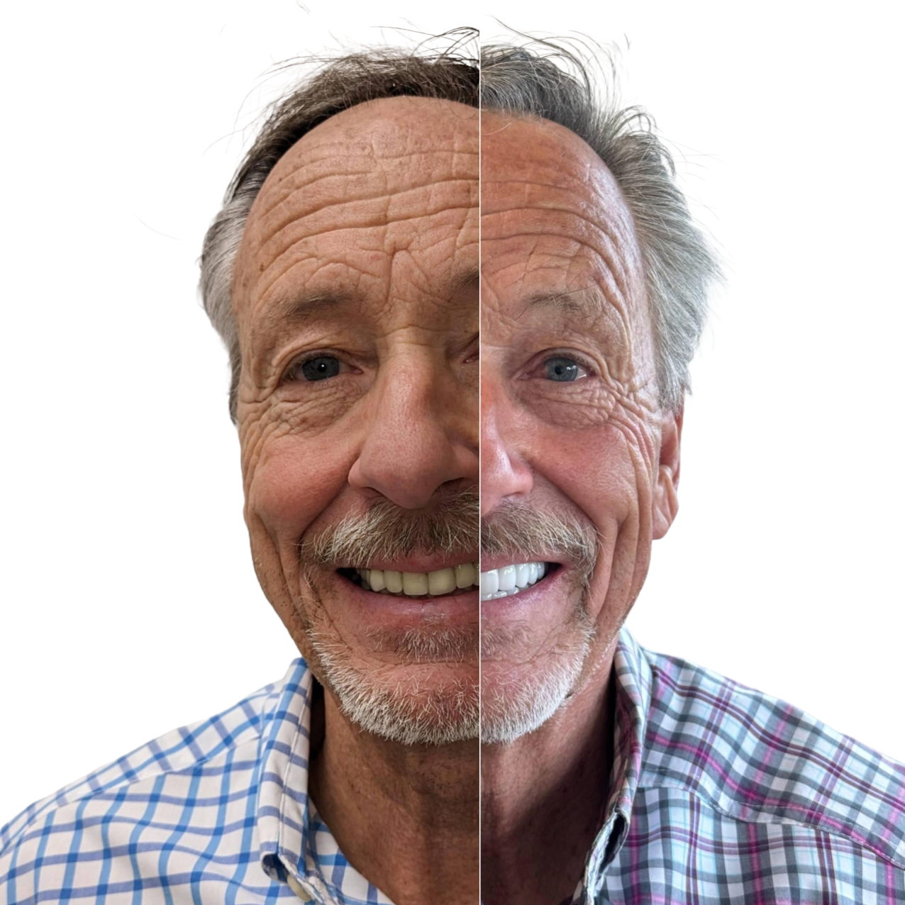 before-after-smile-clinic-usa