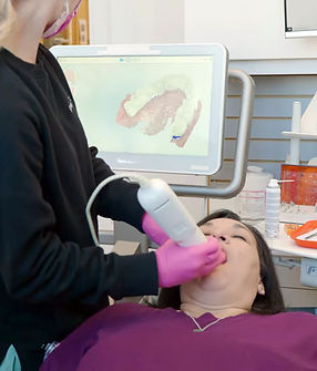 Intraoral scan at a dental office