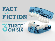 Fact vs. Fiction: Misconceptions About 3 on 6 Dental Implants and Bridges