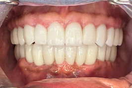 retracted_3on6a.jpg