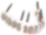 3 on 6 dental implant bridges