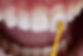 cosmetic_veneers1.jpg