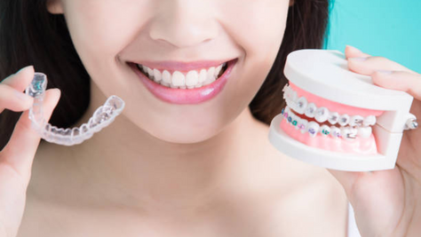 Types of Braces: Metal, Ceramic, and Invisalign